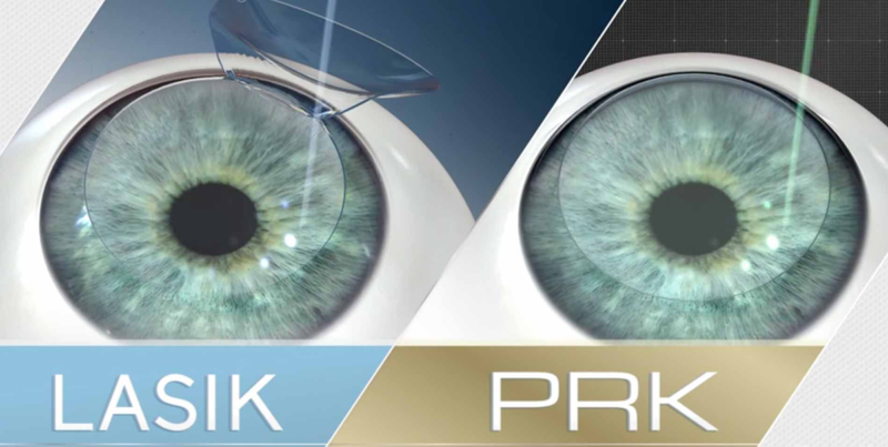 phakic-intraocular-lens-iol-surgery-myvision